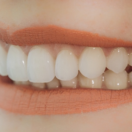 Closeup of a dental bridge in Fresno after placement 