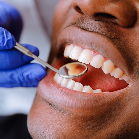Dentist checking patient's tooth colored fillings
