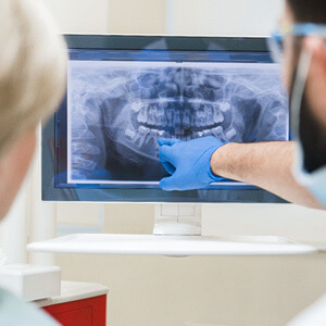 dentist showing patient root canal xrays