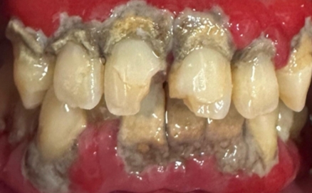 Close up of a mouth with slightly stained teeth
