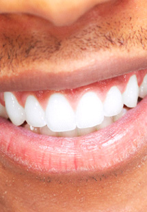 Closeup of a man smiling