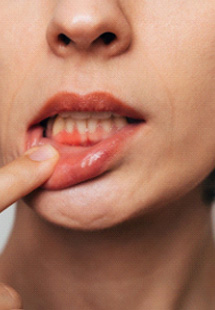 Woman with gum irritation