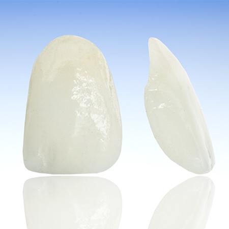 Two metal free dental restorations