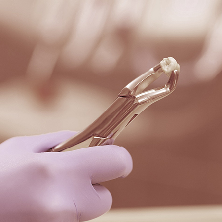 Dentist holding tooth with forceps