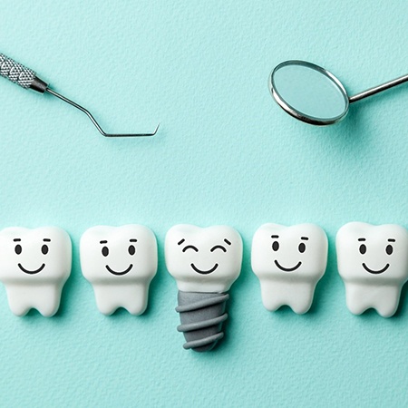 Illustration of dental implants