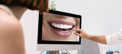 Dentist pointing to smile on computer screen