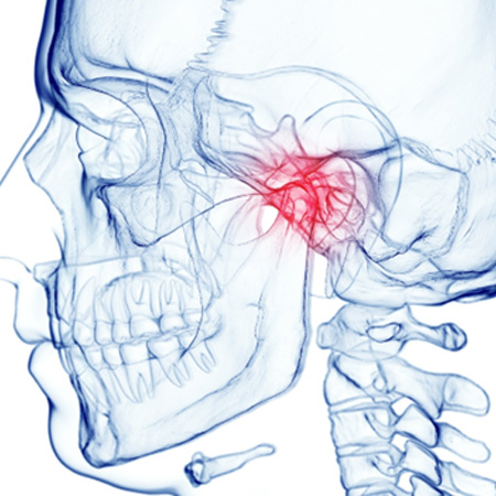 Illustration of the TMJ joint