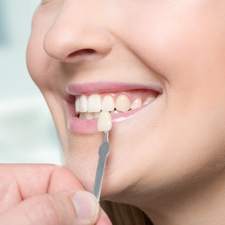 cosmetic dentist holding veneers to patient in Fresno