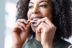 Female inserting an Invisalign aligner
